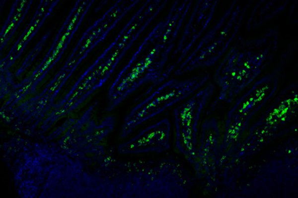 Inmunofluorescencia de intestino