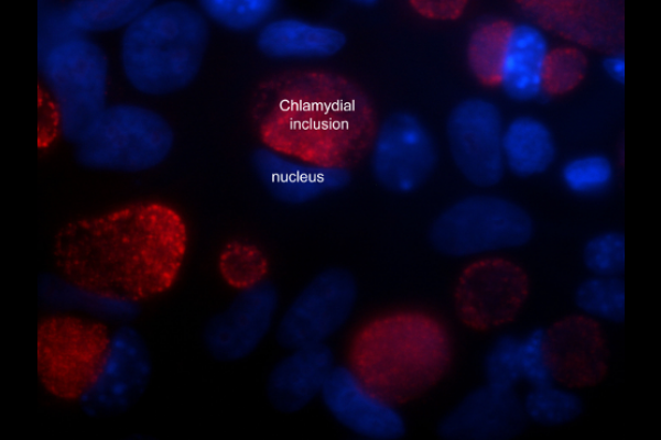 Microbiología celular y molecular de Chlamydia