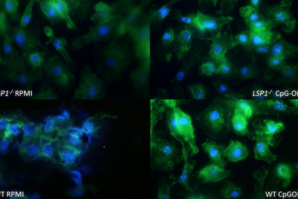 Biología de las Células Dendrítica y de Presentación Antigénica